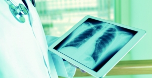 Cancro do pulmão, a doença que mais preocupa os portugueses