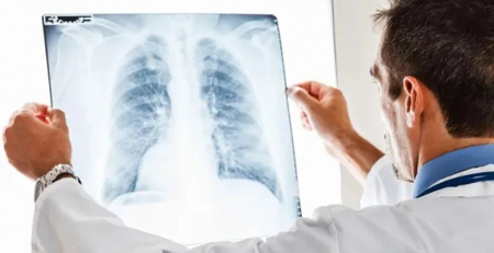 Guidelines para a hipertensão pulmonar apelam a um diagnóstico precoce